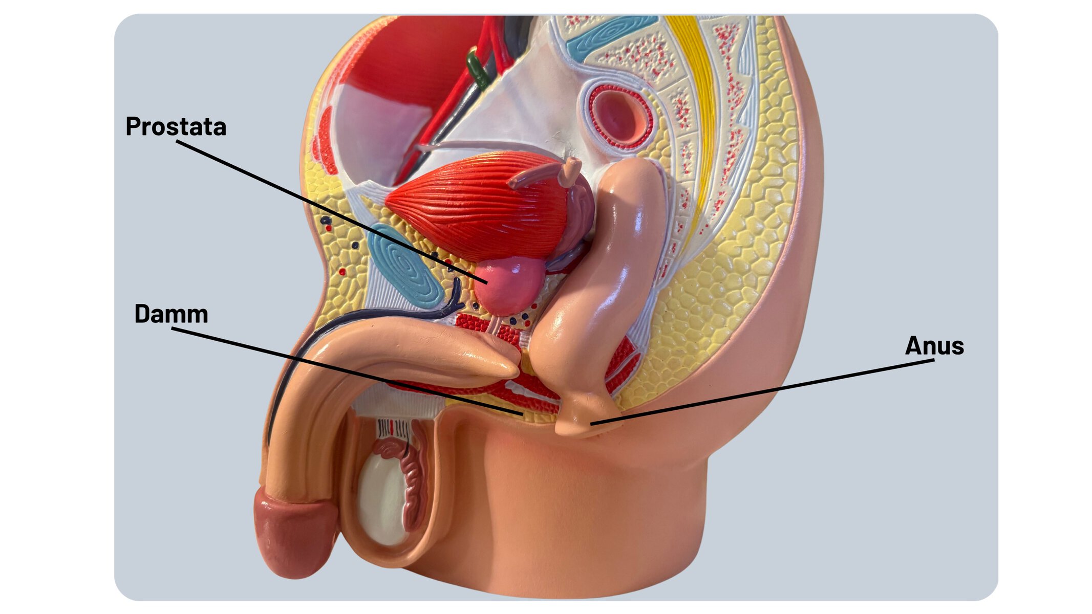 Lage von Prostata, Damm und Anus Anatomisches Modell des männlichen Beckens mit Prostata, Damm und Anus